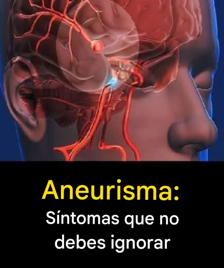 Aneurisma: señales que no debes ignorar…