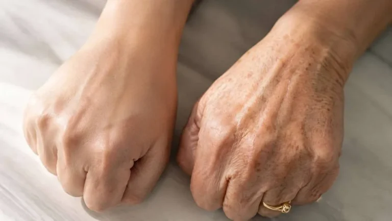 Así puedes reducir la apariencia de las manchas de la edad